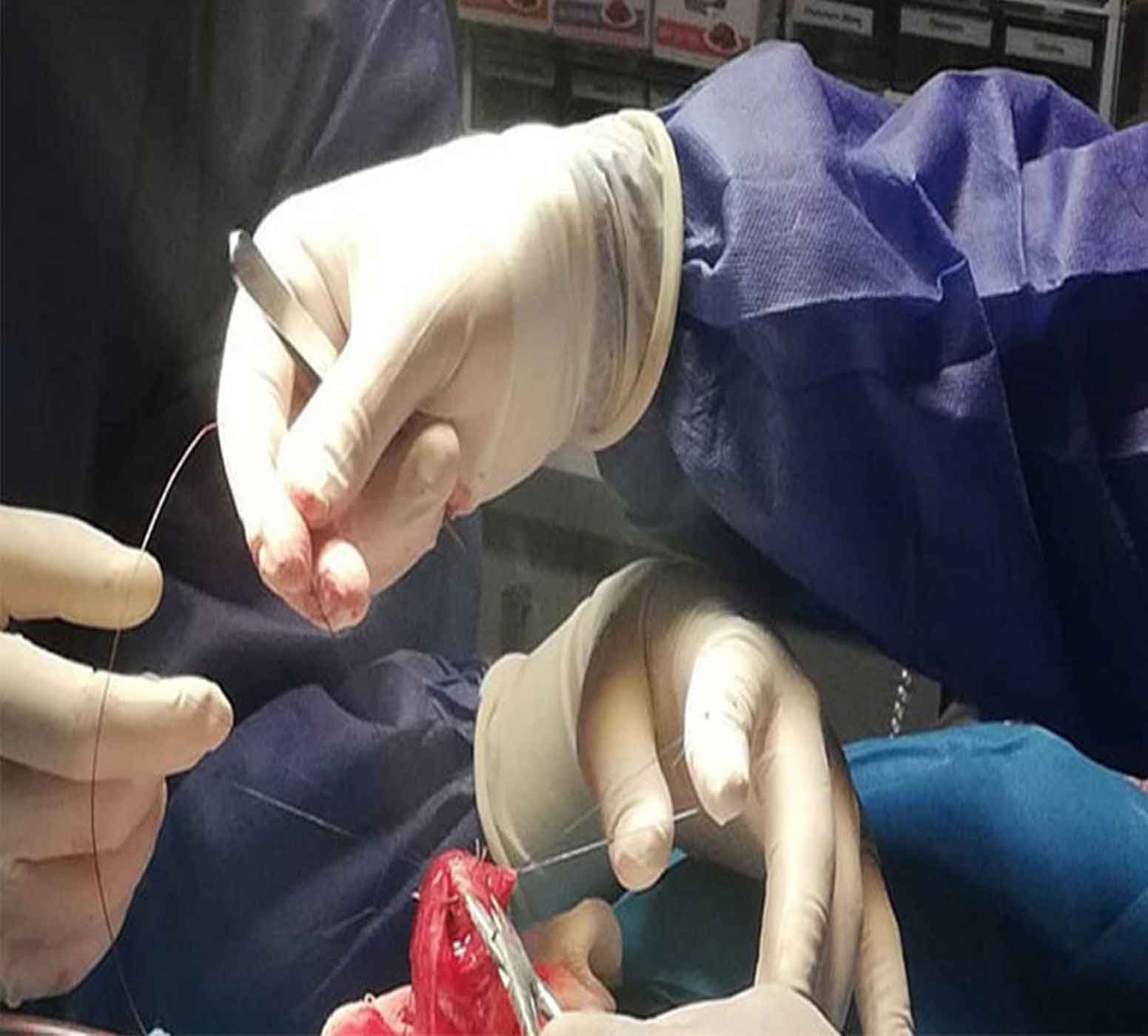 جراحی سرپایی در درمانگاه ظفرآریا